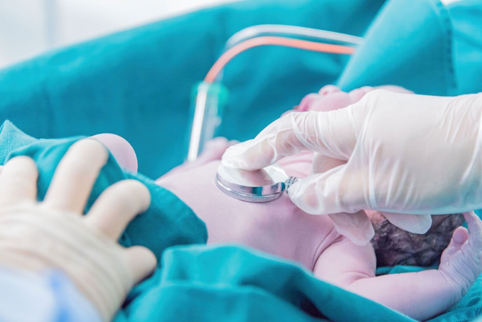 Médico auscultando a un recién nacido con estetoscopio